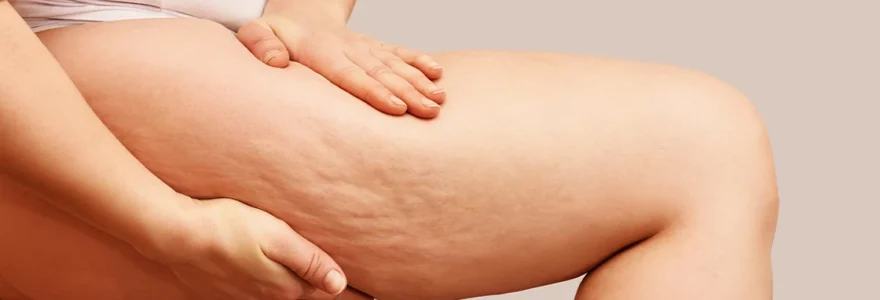 Comment combattre la cellulite